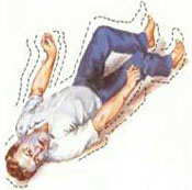 西安的治疗癫痫病医院