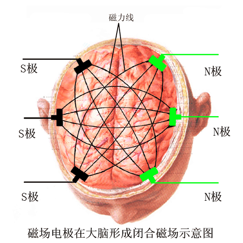 西安治疗癫痫的医院在那里